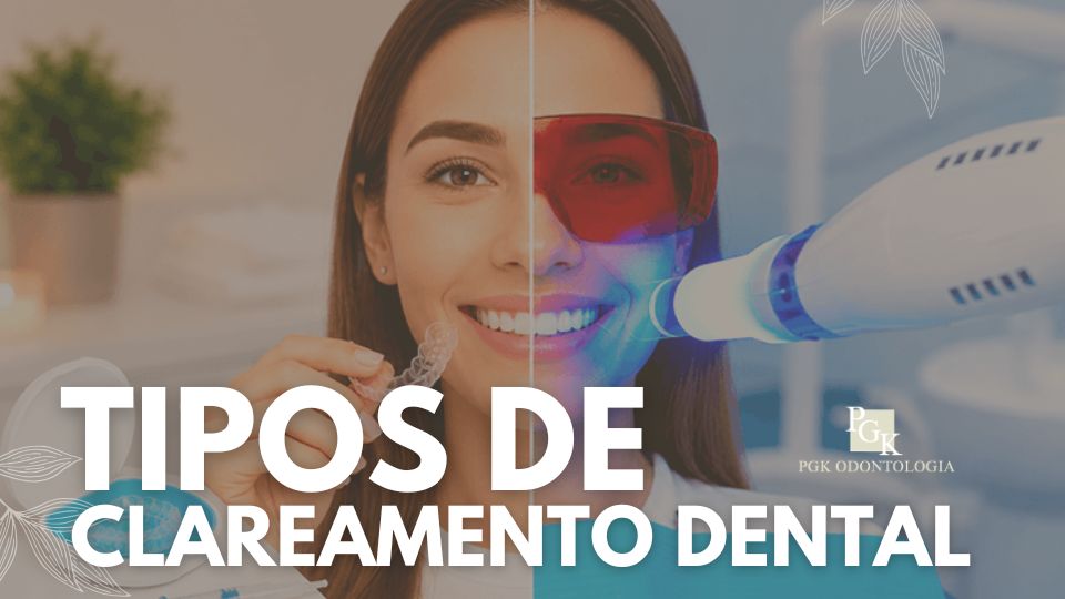 Tipos de clareamento dental