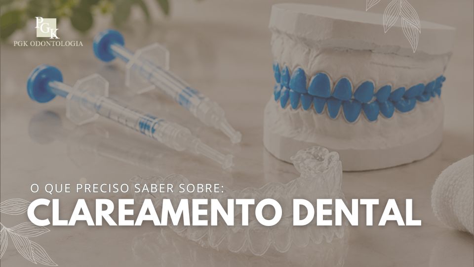 O que preciso saber sobre clareamento dental